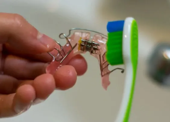 Jakie nawyki warto wprowadzić przy noszeniu ruchomego aparatu na zęby?